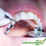 مراجعه هر سال ۱۰ میلیون نفر به مراکز دندانپزشکی فرهنگیان