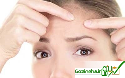 کارهایی که شما را مستعد جوش و آکنه می‌کند